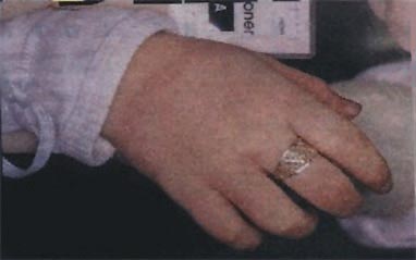 right hand ring
